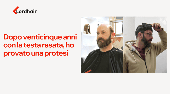 Dopo venticinque anni con la testa rasata, ho provato una protesi