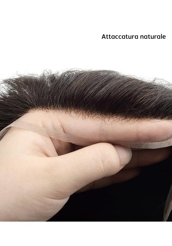 l3 hair replacement system