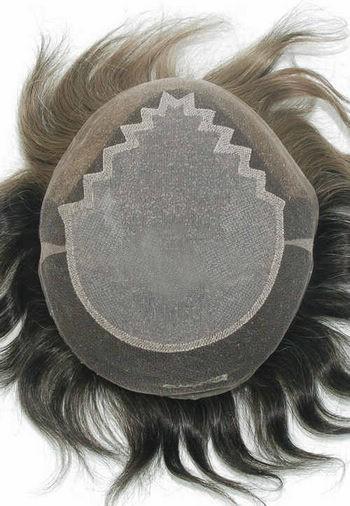 jq1307 hair replacement system
