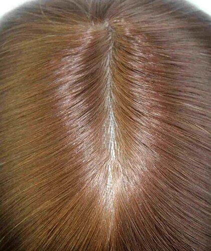 JQ1516: Realistic Thin Skin Flat Injected Human Hair Thin Skin Hair System