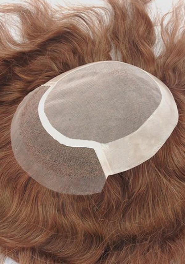 l6 hair replacement system