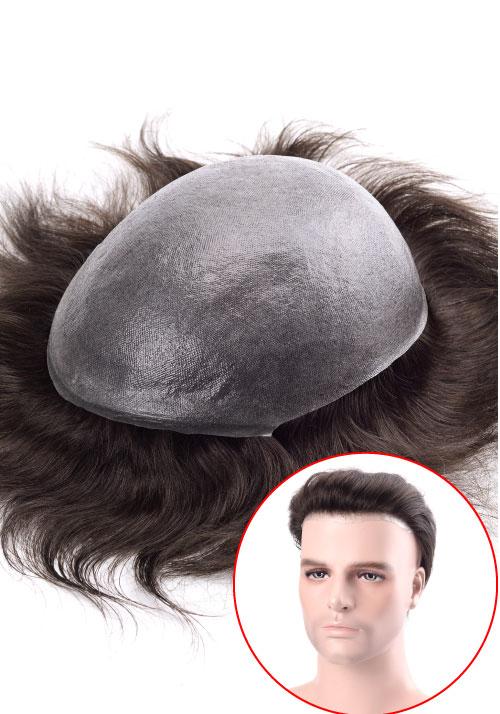 S1 hair replacement system