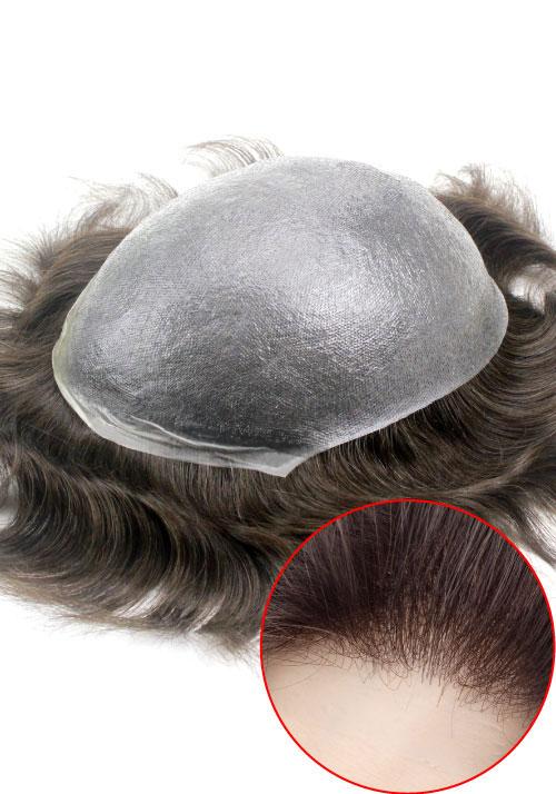 s22 hair replacement system