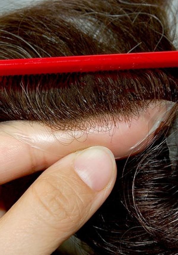 S22 Impianto Capillare Stock
