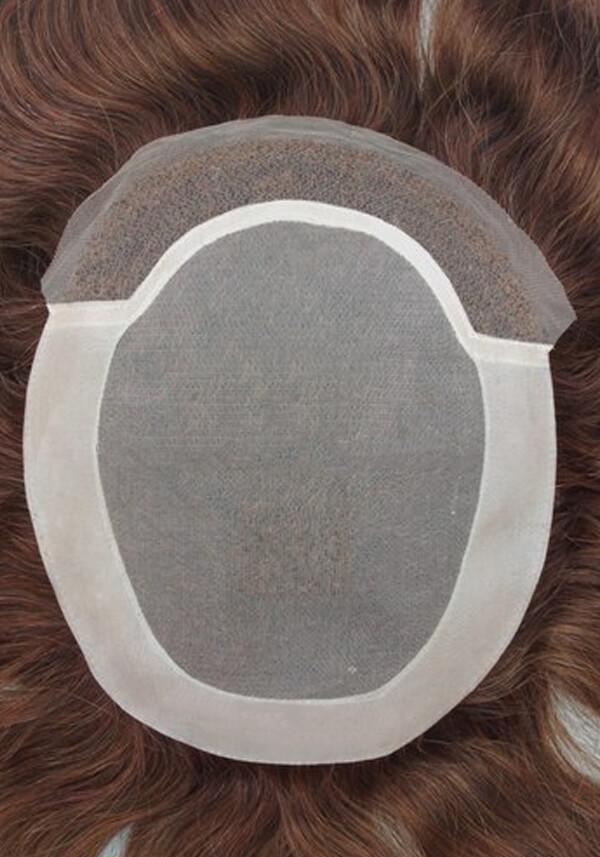 l6 hair replacement system