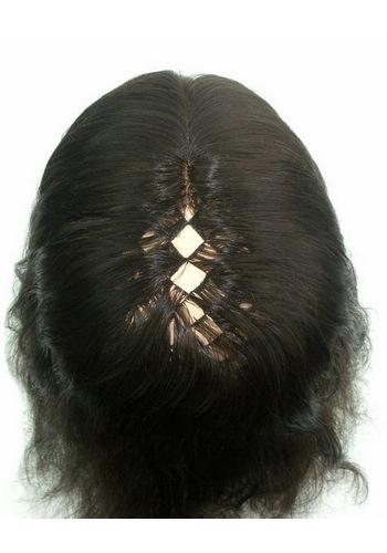 yj176 hair replacement system