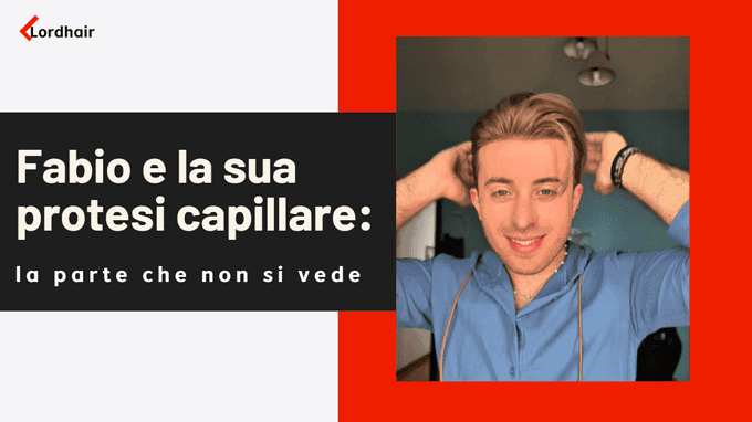 Fabio e la sua protesi capillare: la parte che non si vede