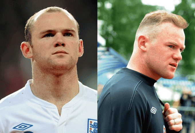Wayne-Rooney-con-la-parrucca
