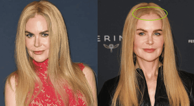 Nicole-Kidman-con-la-parrucca
