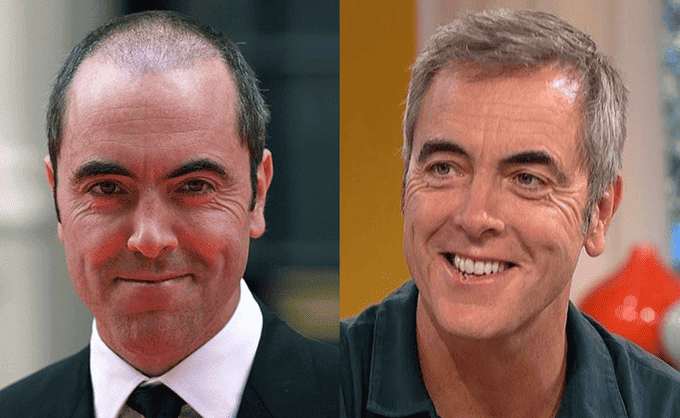 James-Nesbitt-con-la-parrucca