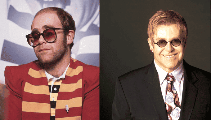 Elton-John-con-la-parrucca