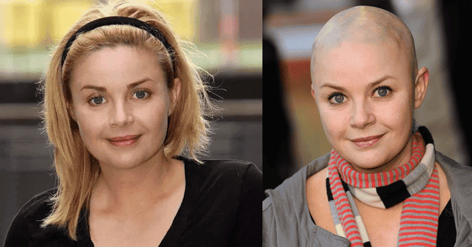 Gail-Porter-con-la-parrucca