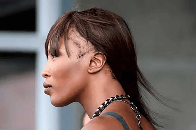 Naomi_Campbell_con_alopecia_da_trazione