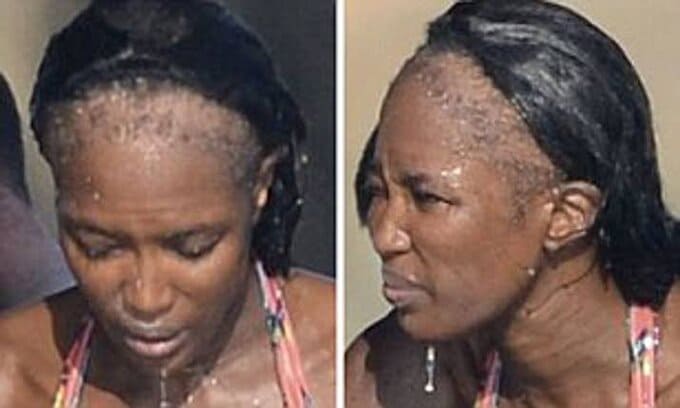 foto_Naomi_ Campbell_perdita_di_capelli