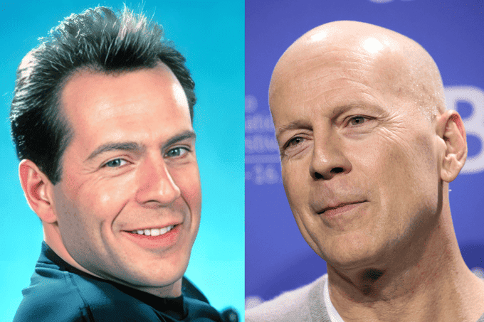 Bruce Willis con e senza capelli