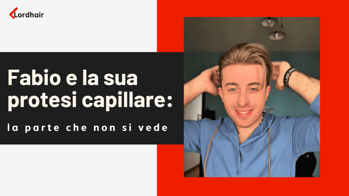 Fabio e la sua protesi capillare: la parte che non si vede