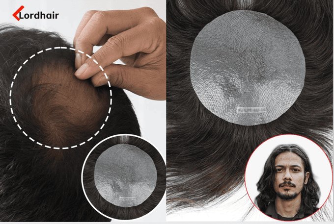 patch capelli vertex per coprire il diradamento sulla corona o sul vertice