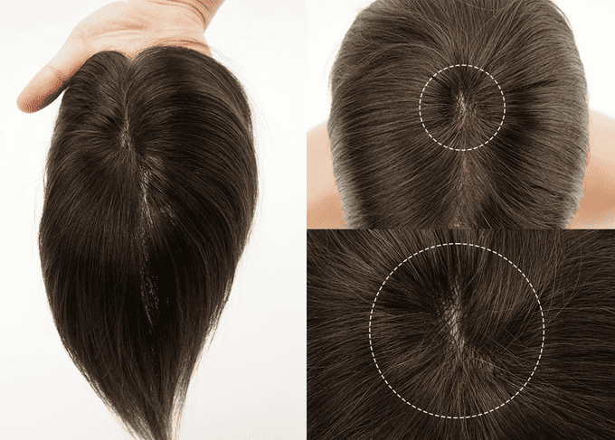 vertice patch capelli lordhair che serve a coprire il vertex diradato