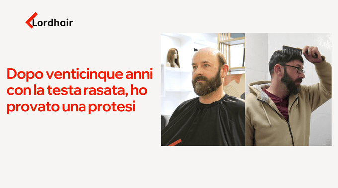 Protesi capelli uomo prima e dopo: John prima dell'applicazione (testa rasata) e dopo il primo mese con la Quanta Lordhair
