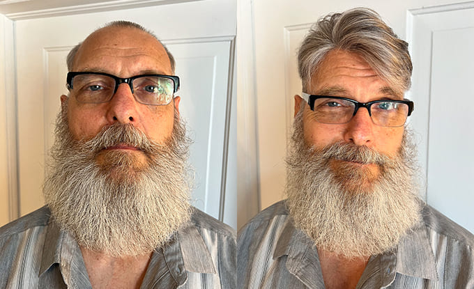 Cliente prima e dopo un sistema di capelli su misura con grigio distribuito uniformemente