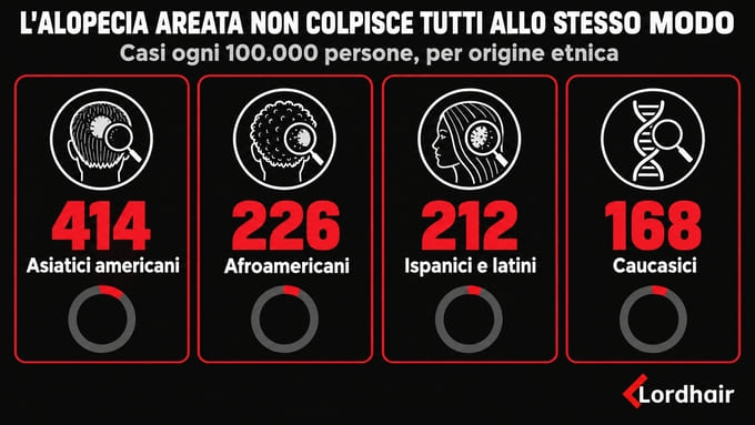 Confronto della prevalenza di alopecia areata tra diverse origini etniche, più alta tra gli asiatici americani