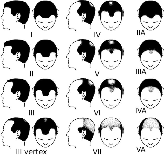 acconciature da uomo