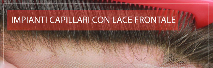 Prosei Capelli con Lace Frontale Prosei Capelli con Lace Frontale