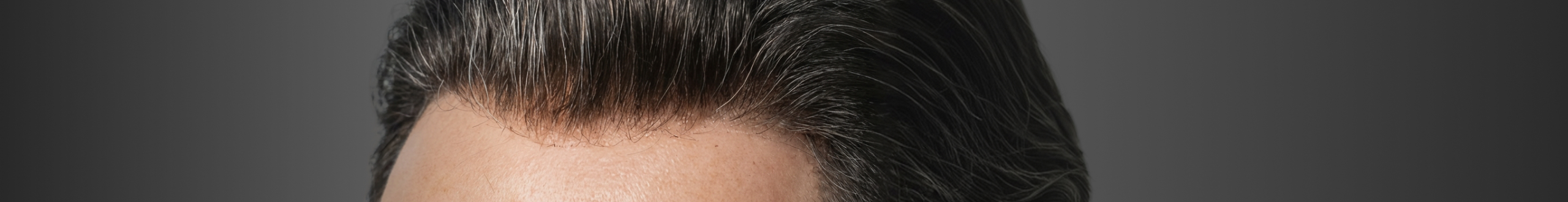 Protesi di Capelli Sfoltiri & Leggeri