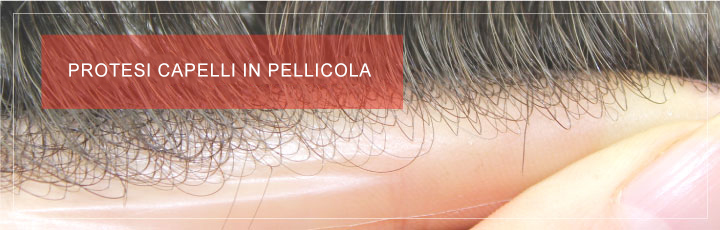 Protesi Capelli in Pellicola Protesi Capelli in Pellicola