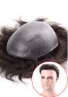 S1 hair replacement system