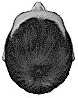 hair replacement center crown