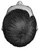 hair replacement right break