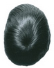 hair replacement right crown