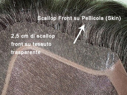 skin hair replacement scallop front