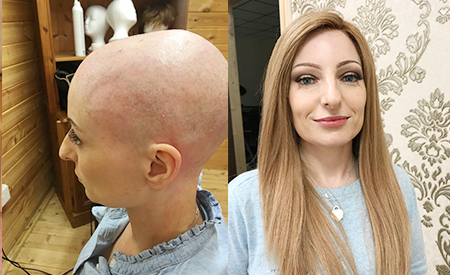 Prima e dopo