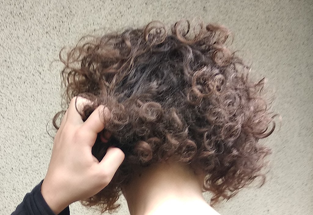 Alopecia comprensione