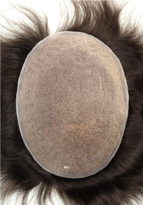Sistema tricologico in lace