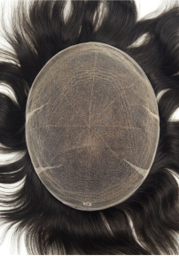 Sistema tricologico in lace