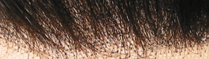 Nodi non schiariti