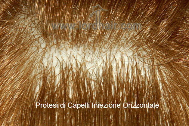 Capelli iniettati orizzontalmente