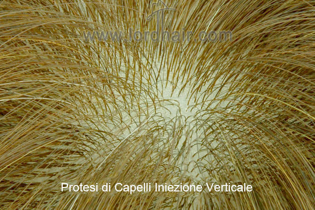 Capelli iniettati verticalmente