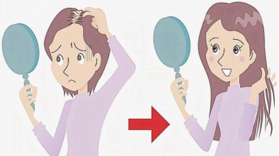 Protesi capelli cos'è