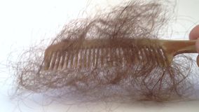Caduta capelli post parto