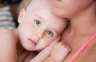 Alopecia nei bambini