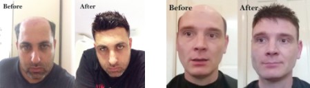Fotografie "Prima - Dopo"