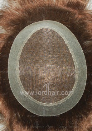 Impianti Capillari Mono Lace