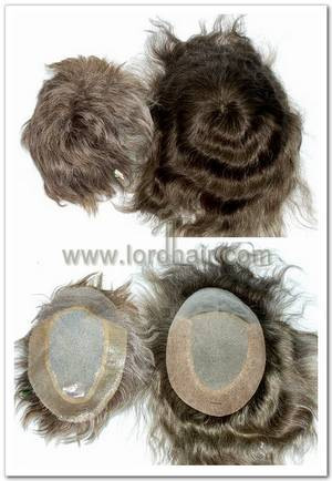 hair duplication hair duplication