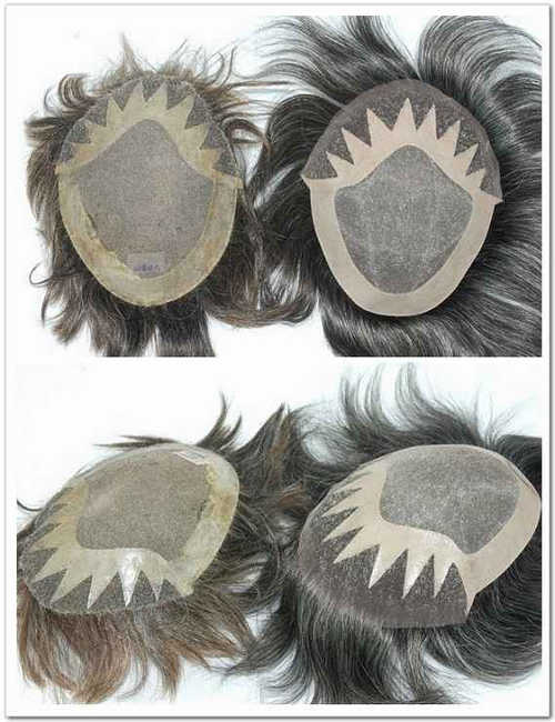 hair duplication hair duplication