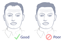 order not enough hairline recession