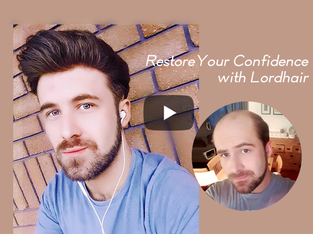 Cambiare Vita con un Infoltimento di Capelli Non-chirurgico Lordhair